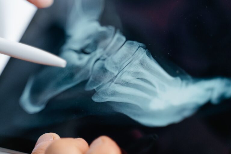 Grounding Research for Rheumatoid Arthritis: Biomarkers & Inflammation - groundinge